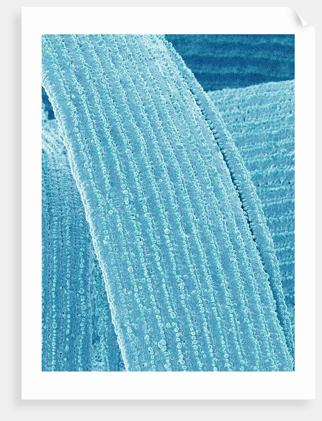 Lens fiber of eye (rabbit) by Anonymous