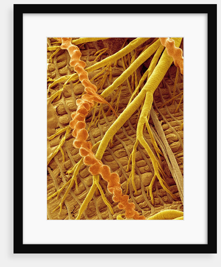 Interior of Moth larva by Anonymous
