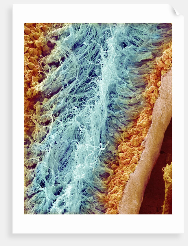 Sperm in rat testes by Anonymous