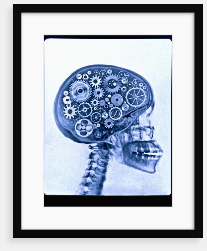 X-ray of skull with gears by Anonymous