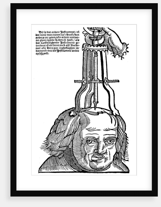 Trepanation by Anonymous