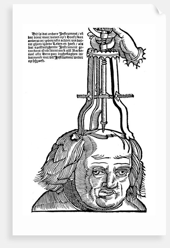 Trepanation by Anonymous
