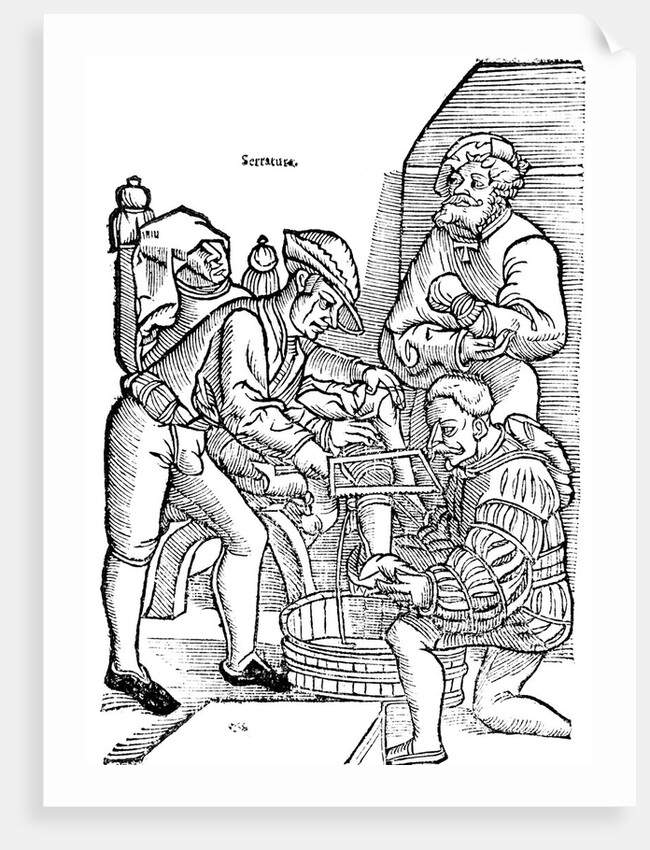 Amputation of a leg without anesthetic by Anonymous