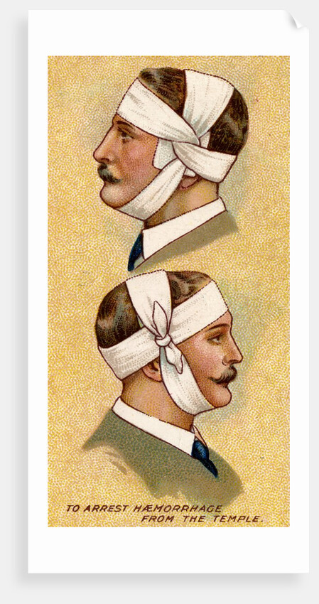 Man with bandaged head by Anonymous