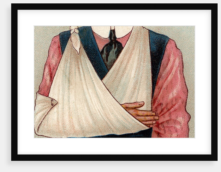 Arm in sling by Anonymous