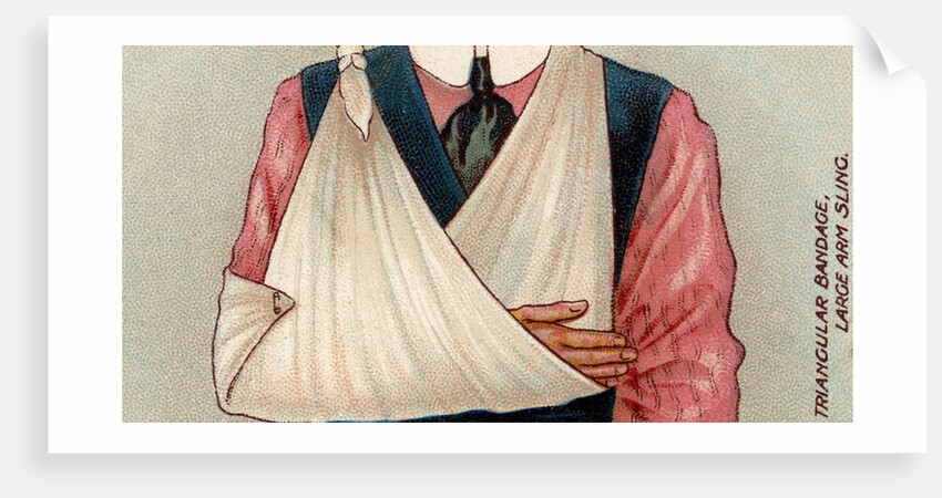 Arm in sling by Anonymous