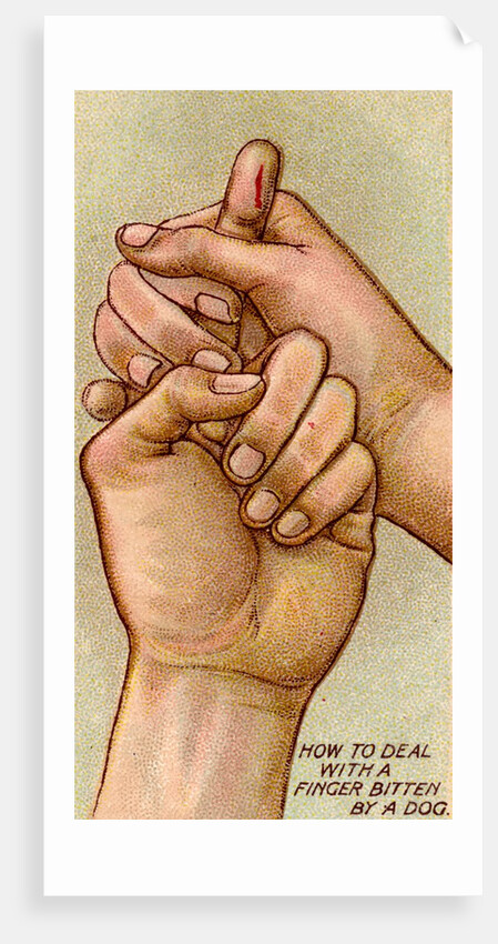 Bleeding finger by Anonymous