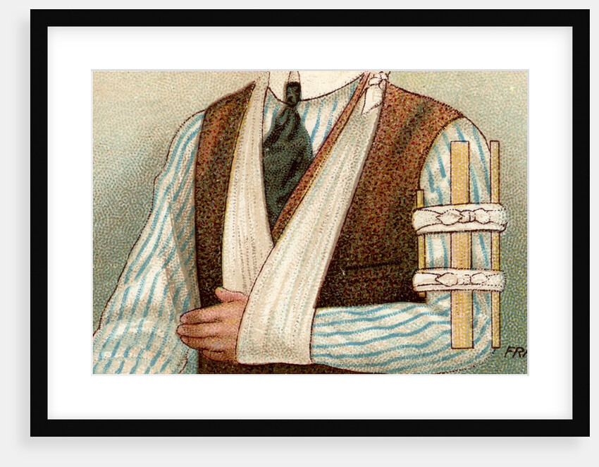Man with sling and splint by Anonymous