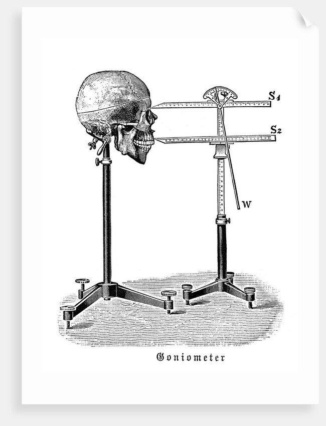 Goniometer measuring human skull by Anonymous