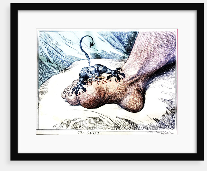 The Gout by Anonymous