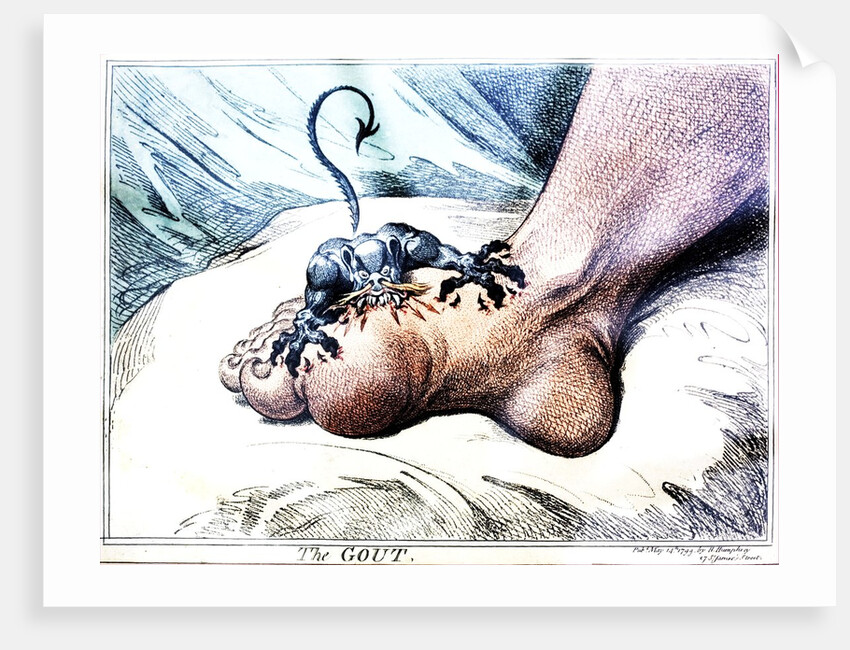 The Gout by Anonymous