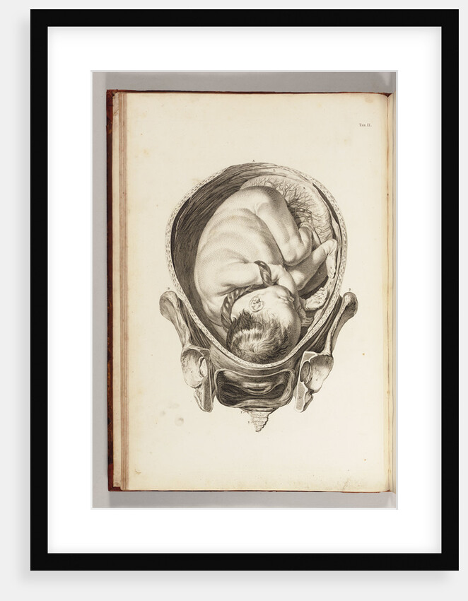 Engraving of a child in the womb by William Smellie