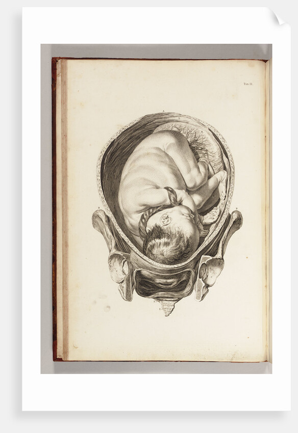 Engraving of a child in the womb by William Smellie