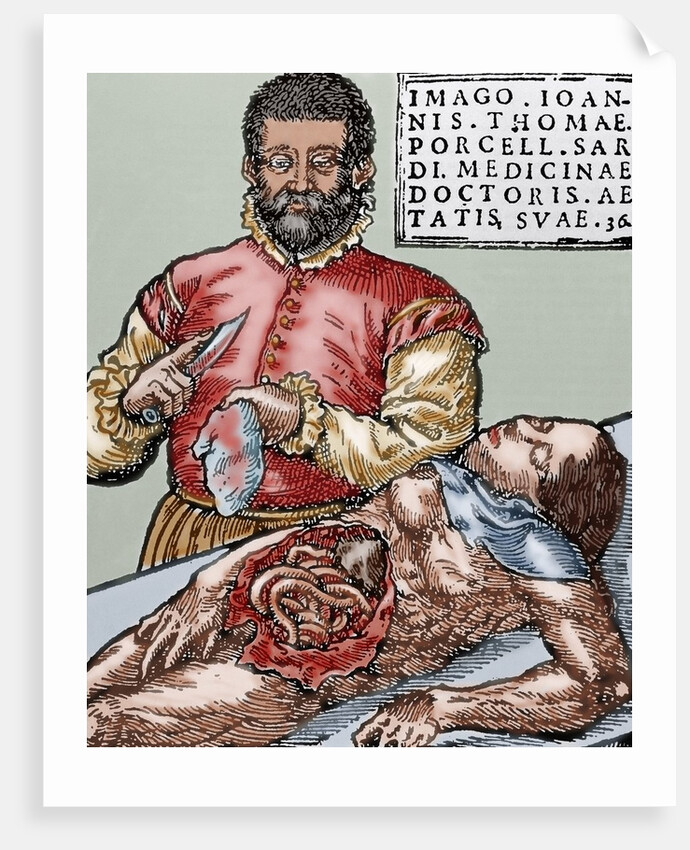 John Thomas Porcell (1528-ca.1580). Spanish doctor by Anonymous