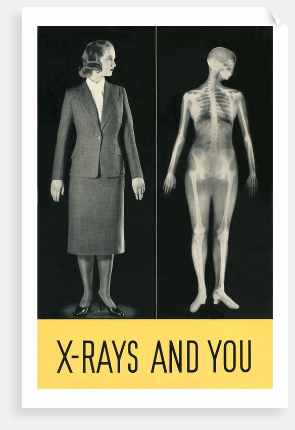 X-Rays and You by Anonymous
