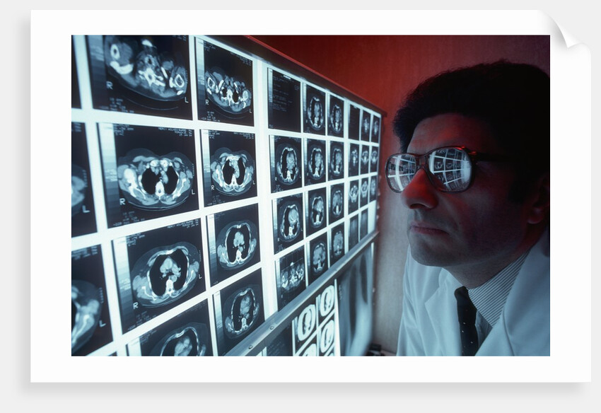 1980s doctor examining CAT scan by Anonymous