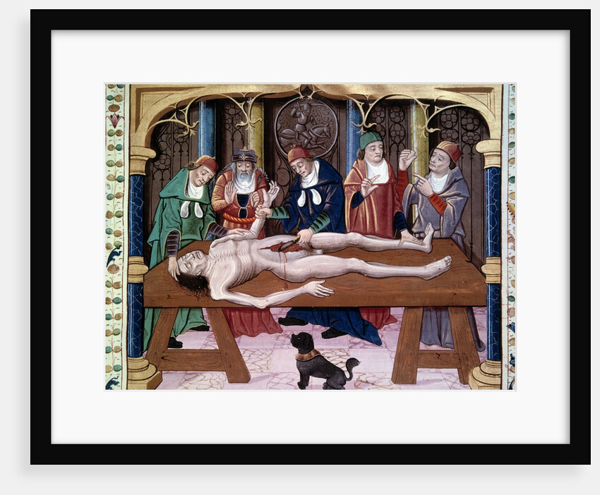 Autopsy, 15th century by Anonymous