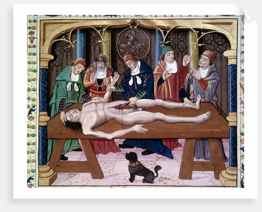 Autopsy, 15th century by Anonymous