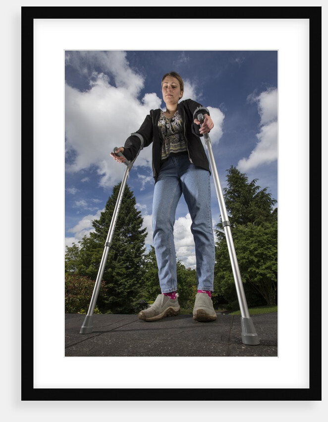 Woman standing on crutches by Anonymous