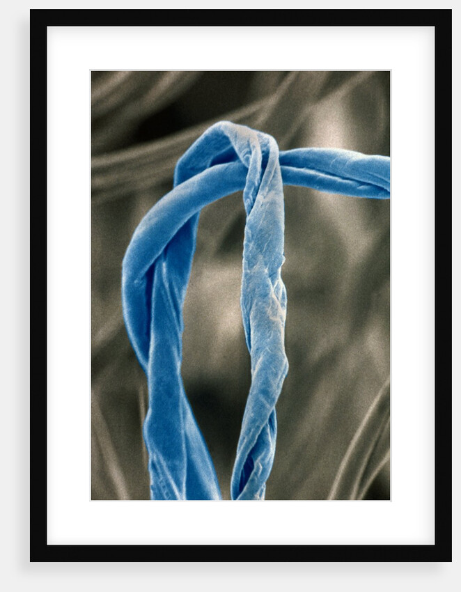 Cotton Fibers by Anonymous