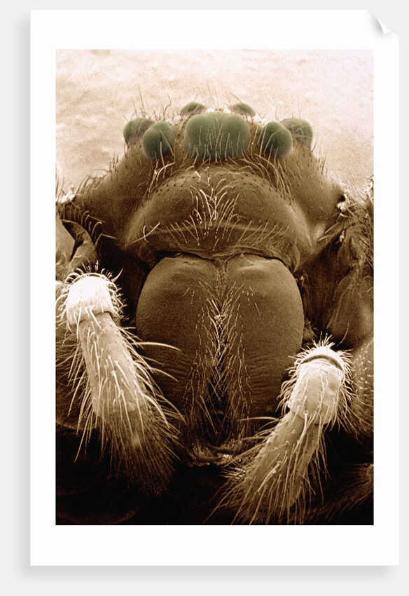 Microscopic View of Black Widow by Anonymous
