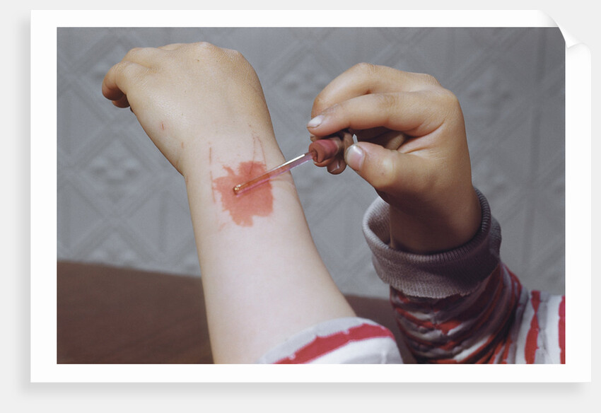 Placing Medicine on Infection by Anonymous