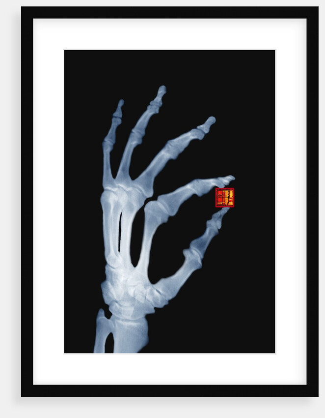 Skeletal Hand Holding Computer Chip by Anonymous
