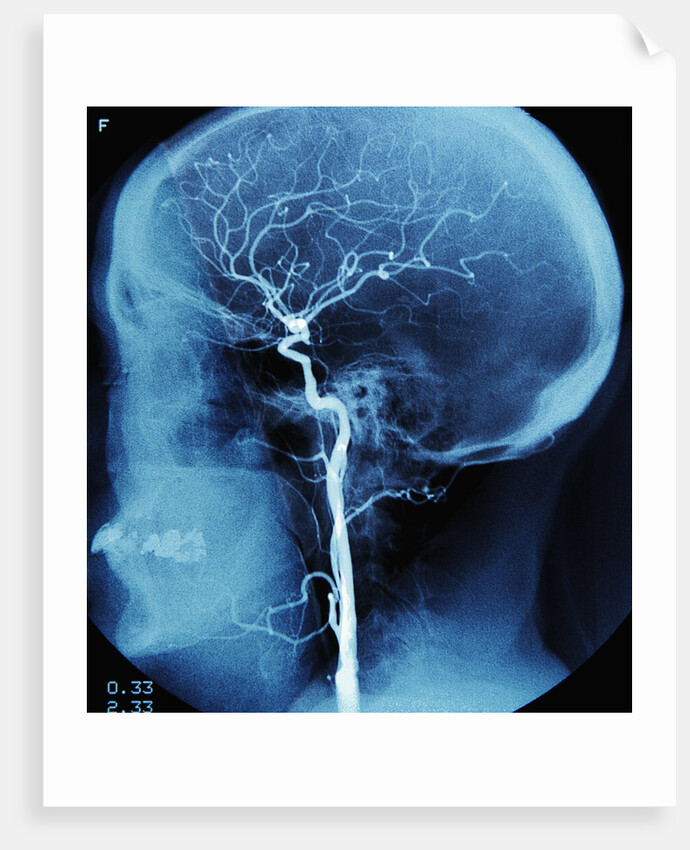 X-Ray of Human Head by Anonymous