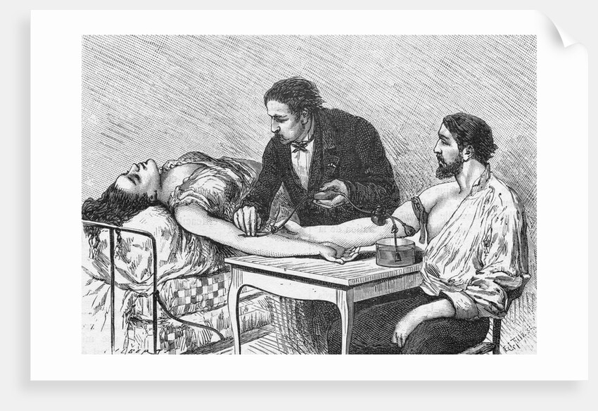 Illustration of a Woman Receiving a Blood Transfusion in February 1882 by Anonymous