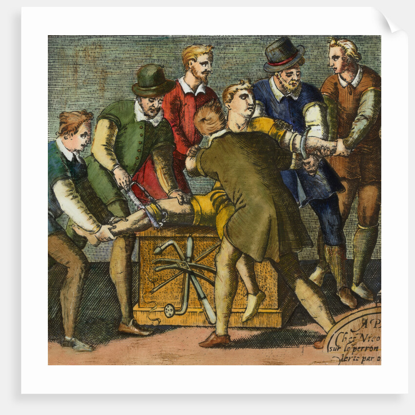 Physician and Assistants during Early History Leg Amputation by Anonymous