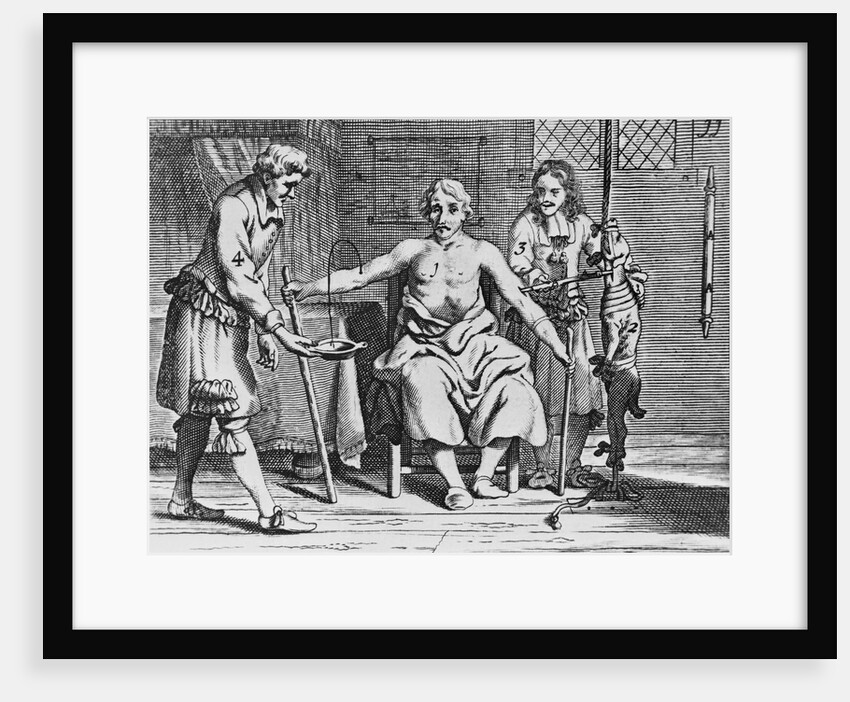 Physicians and Patient During Early Blood Transfusion by Anonymous