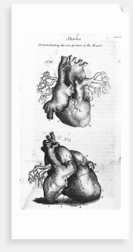 Engraving of Human Heart by Anonymous
