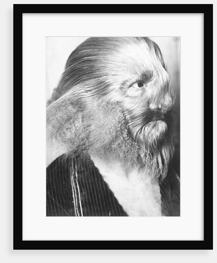 Portrait of a Genetically Hairy Man by Anonymous