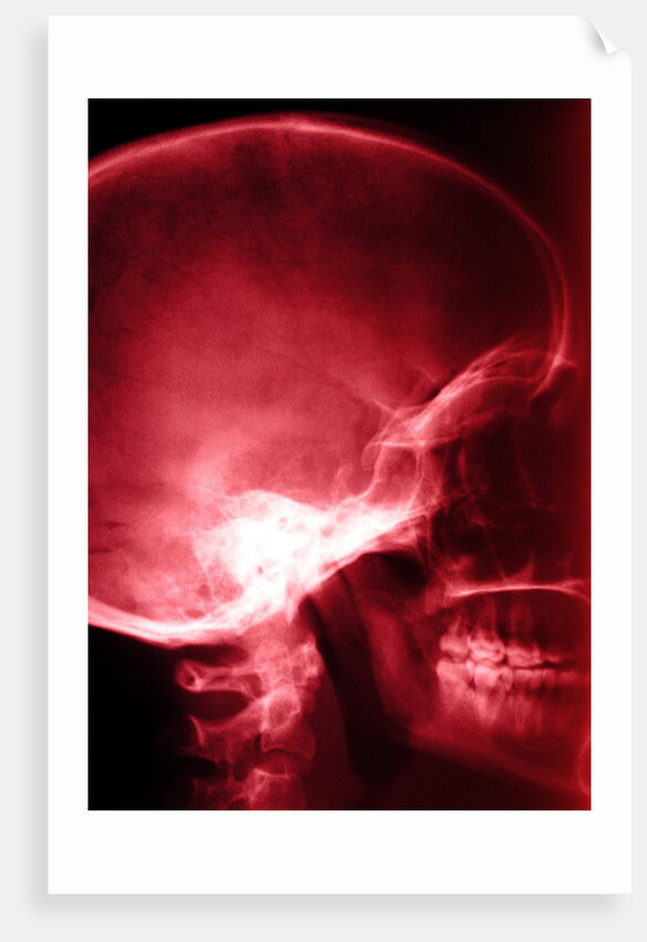 X-Ray of Human Skull by Corbis