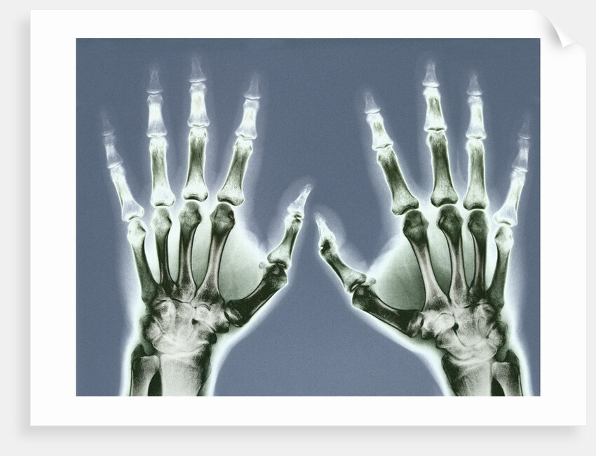 X-ray of Hands by Anonymous