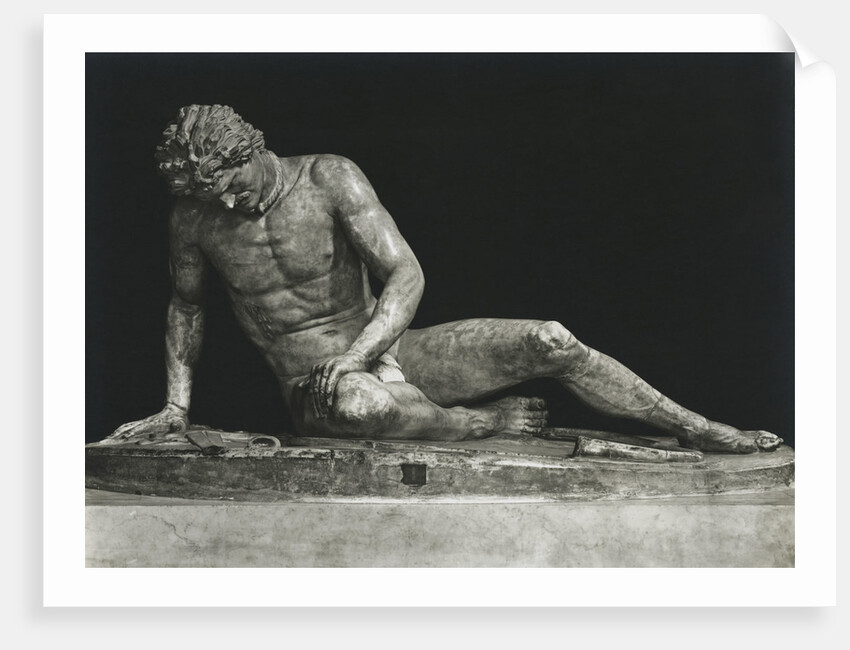 Sculpture of Man Partially Overcome by Anonymous