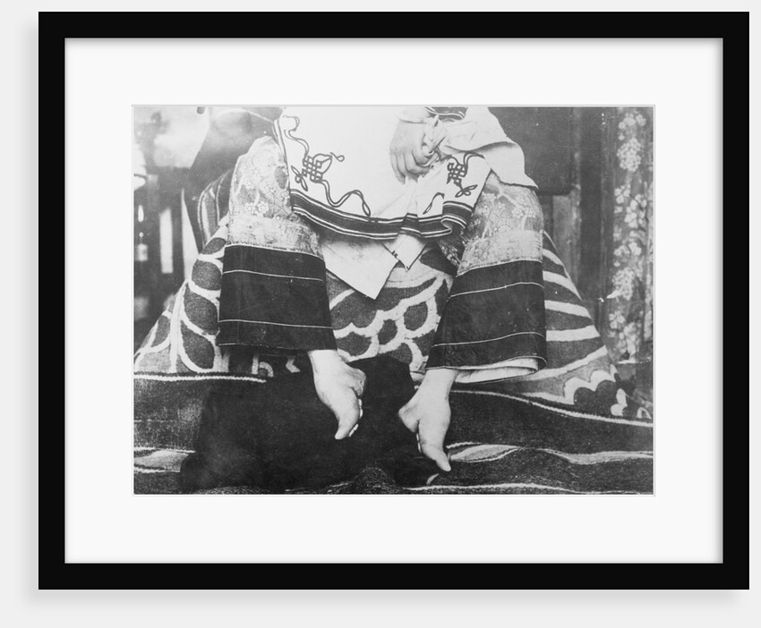 Portrait of Chinese Foot Binding by Anonymous