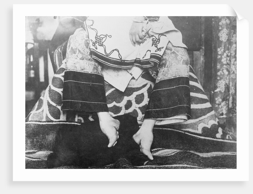 Portrait of Chinese Foot Binding by Anonymous