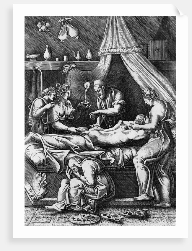 Illustration of Doctor Cupping Patient by Anonymous