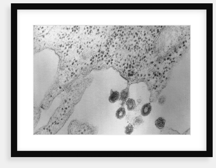 Tumors Budding from Cell Membrane by Anonymous