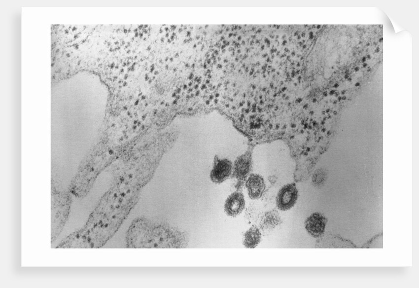 Tumors Budding from Cell Membrane by Anonymous