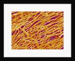 Blood Vessel Cast in Heart of a Rat by Anonymous