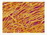 Blood Vessel Cast in Heart of a Rat by Anonymous
