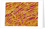 Blood Vessel Cast in Heart of a Rat by Anonymous