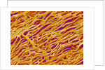 Blood Vessel Cast in Heart of a Rat by Anonymous