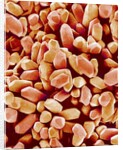 Otoliths of a Rabbit by Anonymous