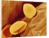 Spores of a Flowering Fern by Anonymous