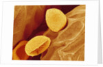 Spores of a Flowering Fern by Anonymous