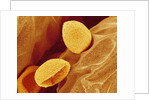 Spores of a Flowering Fern by Anonymous