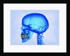 Human Skull by Anonymous